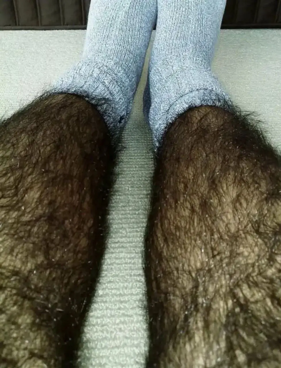 Piernas con vello antes del tratamiento